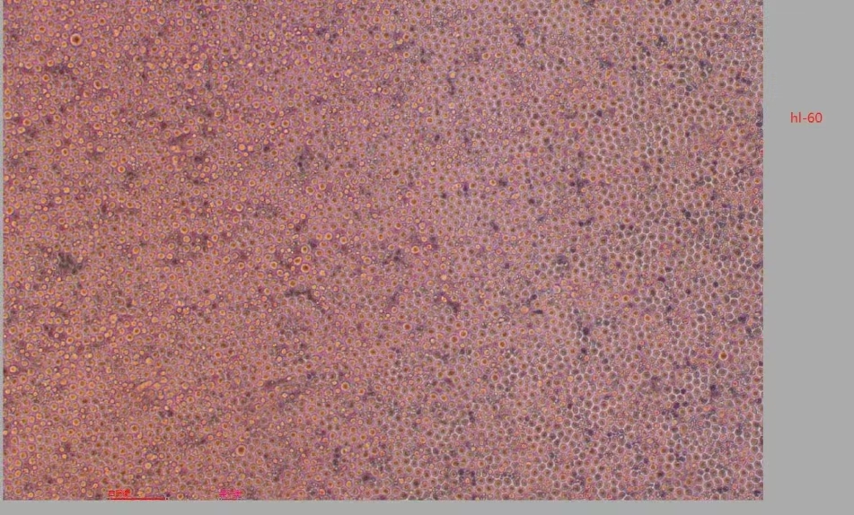 HL-60 人早幼粒白血病細胞
